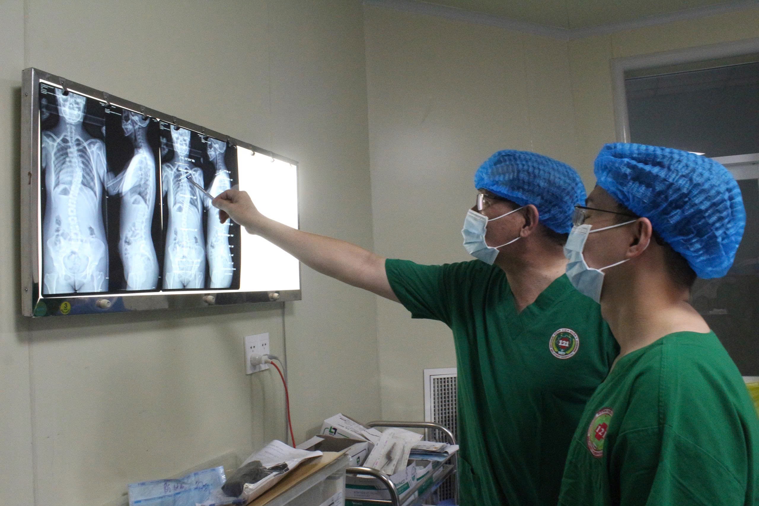 Bệnh viện Quân y 121 điều trị thành công bệnh cong vẹo cột sống - Ảnh 1.