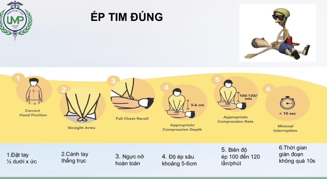 Dấu hiệu cảnh báo biến cố ngừng tim  - Ảnh 1.