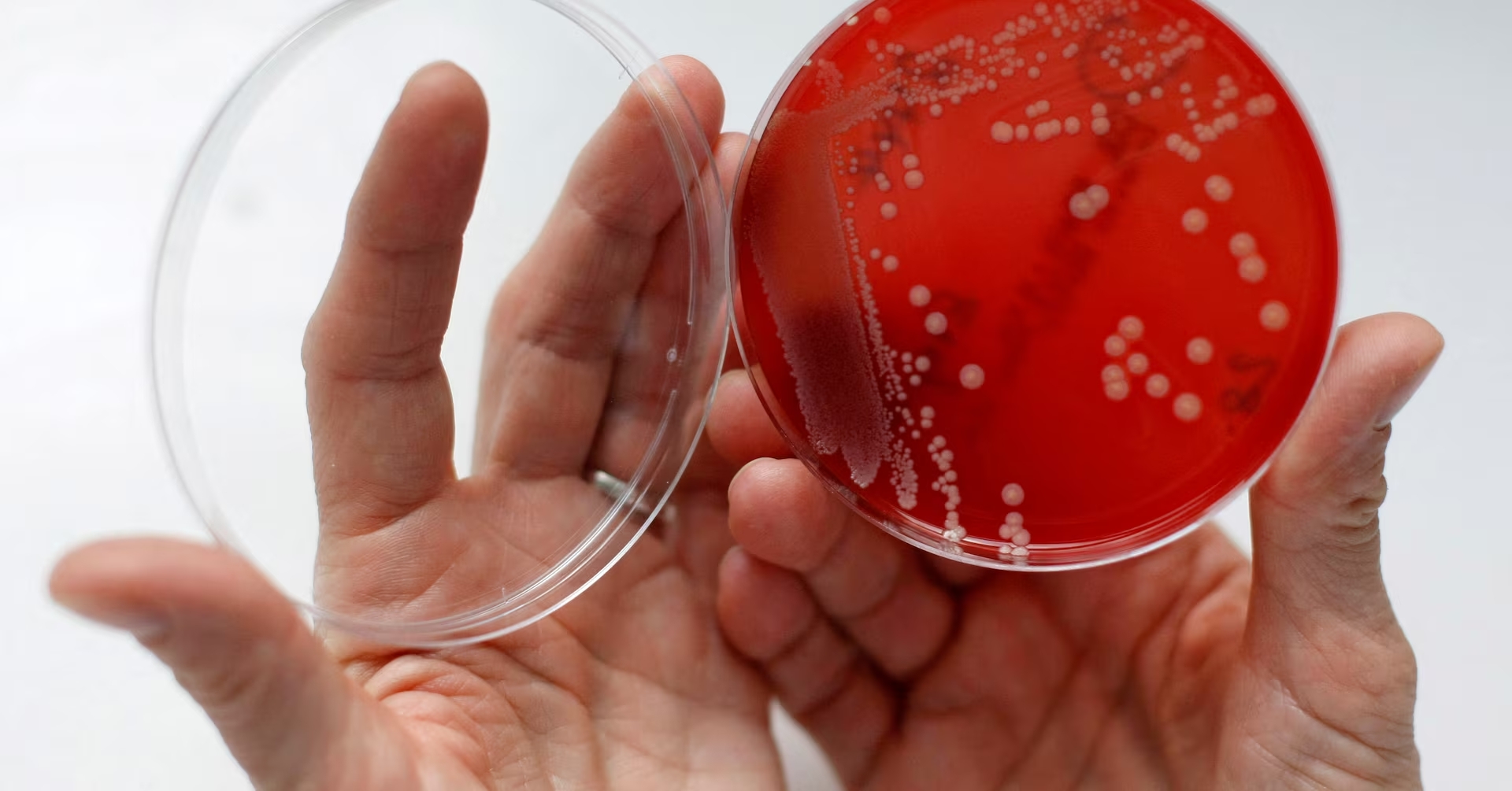 Gia tăng vi khuẩn kháng kháng sinh - Ảnh 1.