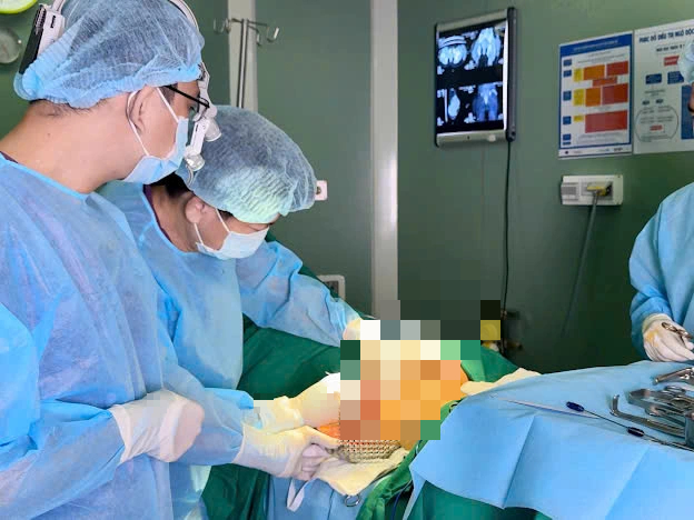 Hút hơn 2,5 lít dịch mủ từ mông bệnh nhân sau 7 năm tiêm filler - Ảnh 1.