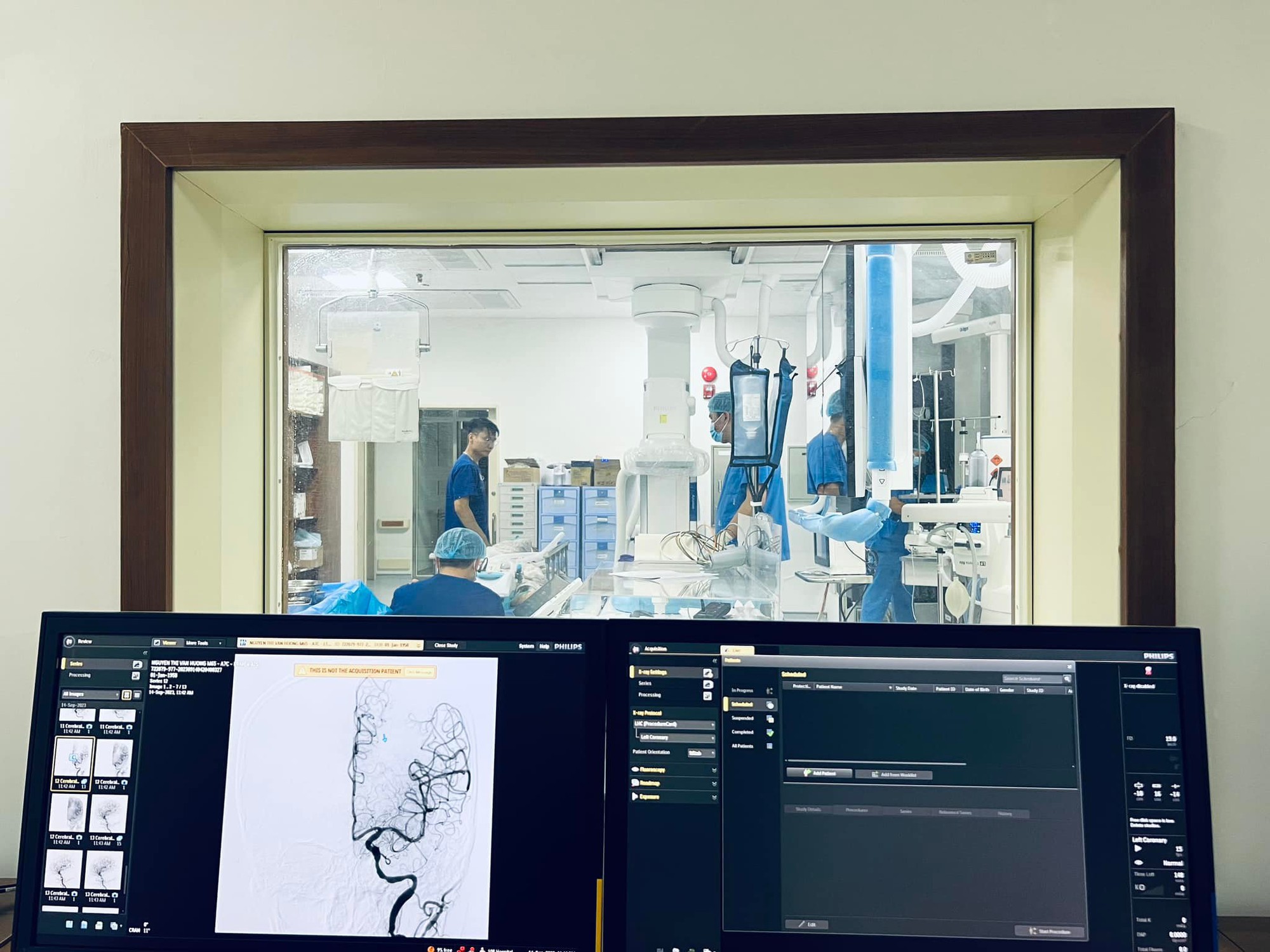 Khoảng 200.000 ca tử vong mỗi năm do bệnh tim mạch- Ảnh 1.