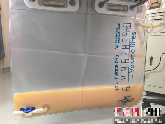 Máu trắng đục như sữa vì chủ quan với 1 việc: Bác sĩ tức giận, nói