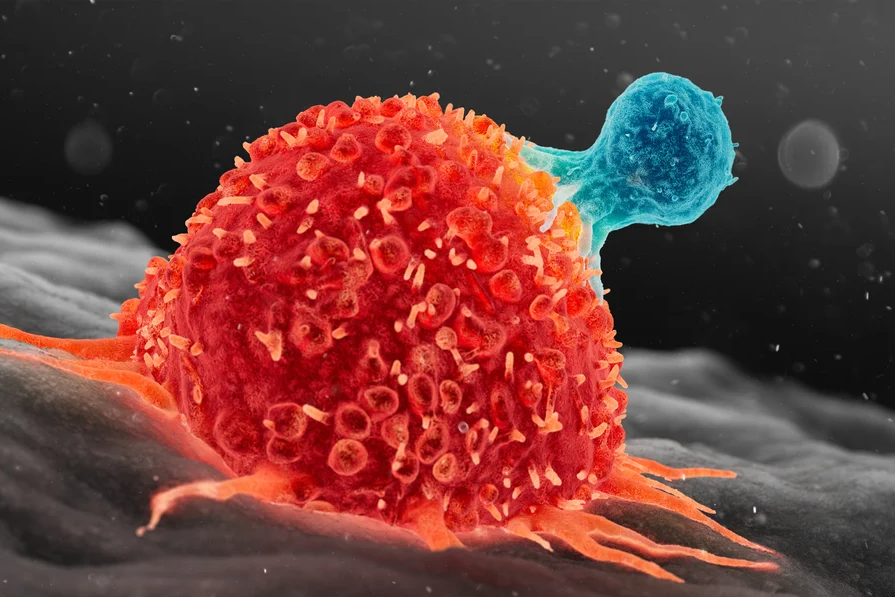 Số ca ung thư sẽ tăng mạnh trong 25 năm tới- Ảnh 1.