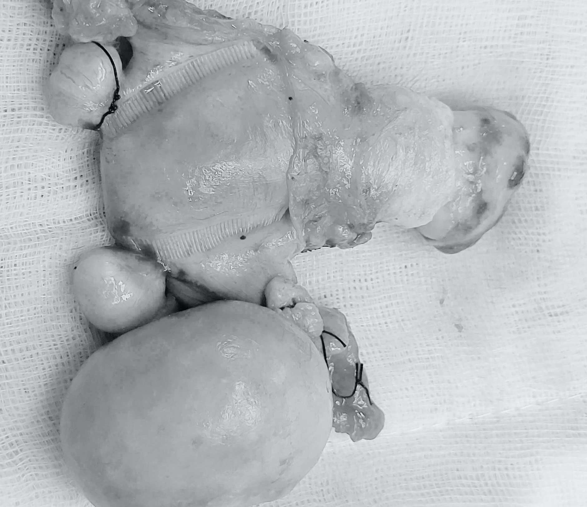 Tưởng chỉ chóng mặt do tăng huyết áp, ai ngờ rơi vào nguy kịch suýt chết - Ảnh 1.