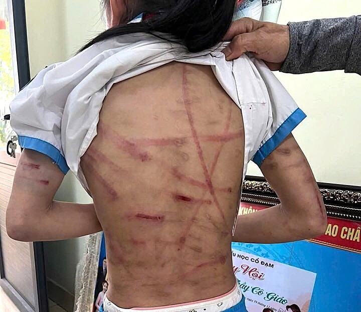 Bắt giữ gã cha dượng bạo hành dã man bé gái lớp 5 ở Hà Tĩnh- Ảnh 1.