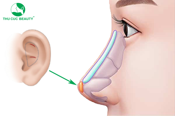 Vị trí bọc sụn tai - tác dụng bảo vệ, che chắn những vật liệu khác