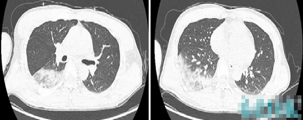 Người đàn ông bệnh nặng vì thích chơi chim- Ảnh 1.
