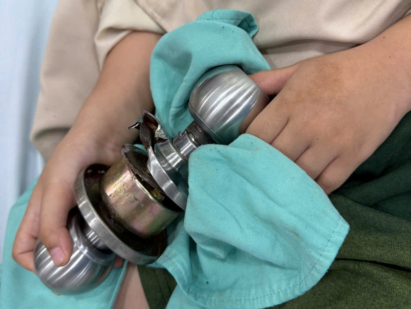 Bệnh nhi ‘ôm’ ổ khóa nhập viện cấp cứu, bác sĩ phát cảnh báo khẩn