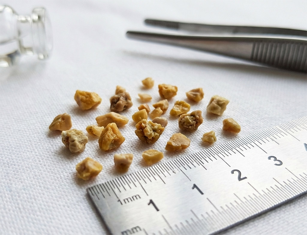 Không bỏ thói quen tưởng vô hại này, suy thận hồi nào không hay - Ảnh 1.