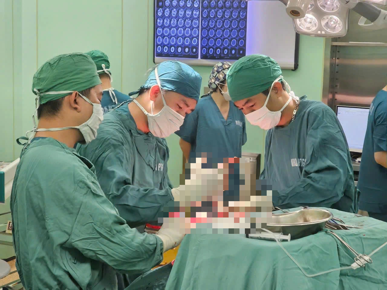 Phẫu thuật cứu sống bệnh nhân chấn thương sọ não nặng tại Vũng Tàu - Ảnh 1.