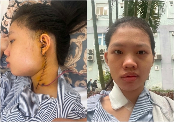 'Em bị ung thư ạ?' - câu hỏi nghẹn lòng của người mẹ trẻ và hành trình hồi sinh vì con