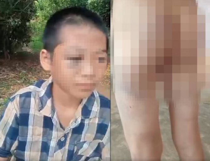 Chi tiết cực đắt trong vụ bé lớp 6 nghi bị mẹ kế và cha bạo hành: Chúng ta cần nhìn lại để dạy con mình!